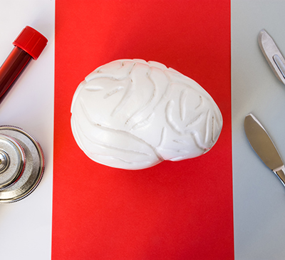 Malignant Glioma - A Pipeline Analysis Report